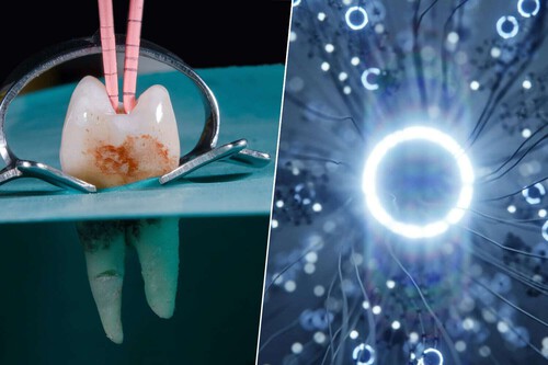 Imagen de Hemos desarrollado un implante dental que parece sacado de 'Blade Runner': crece y es capaz de 'hackear' el cerebro